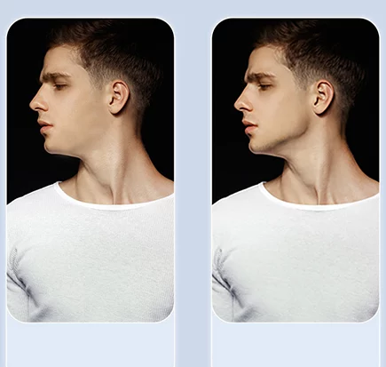 ყბის სავარჯიშო Jaw Exercise